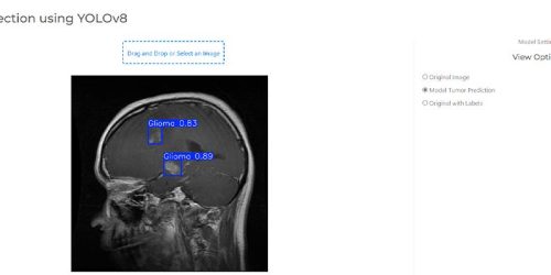 Project_Banner-Detecting_Brain_Tumors_with_AI